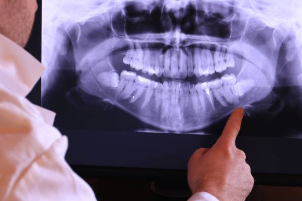 Best Emergency Tooth Extraction in Lewisburg, TN