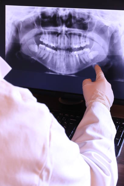 Best Emergency Wisdom Teeth Removal in Lewisburg, TN